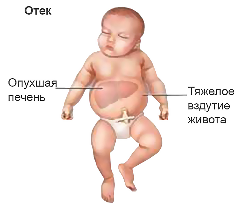 pervaya-otricatelnaya-gruppa-krovi